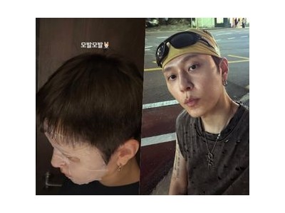 용준형 모발 걱정에 직접 해명 팬들과 소통하며 활동 예고