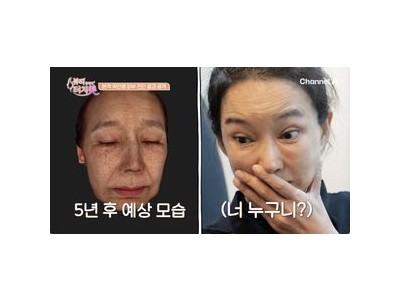 곽진영 충격적인 모습으로 근황 털어놓아
